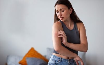 Psoriasis: tratamiento oportuno es clave para mejorar calidad de vida de pacientes