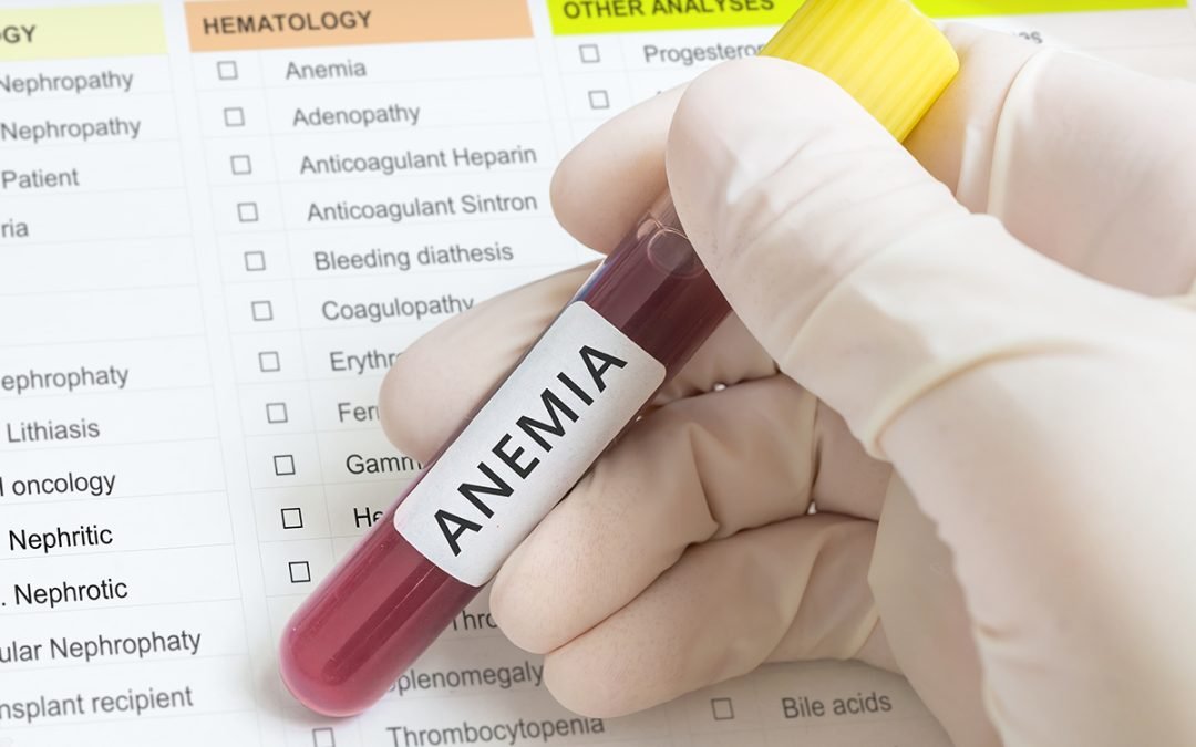 Anemia podría revelar enfermedad de la sangre en adultos